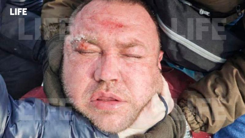 Появилось фото задержанного в Ленобласти мужчины, подозреваемого в убийстве мальчика